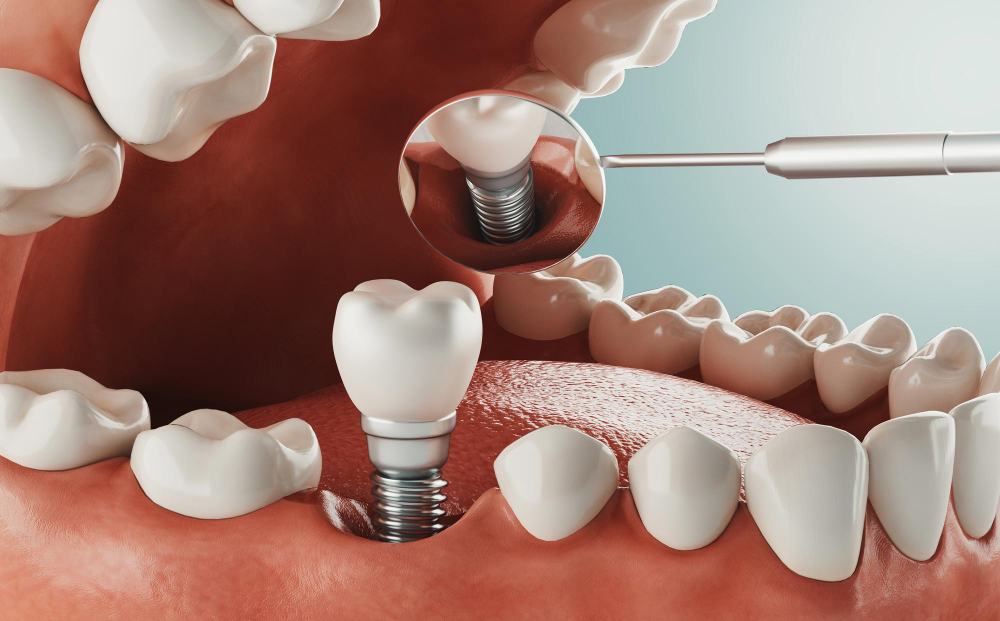 Dr. Zaki’s International Dental Care, Dr. Mohammed Zakiuddin