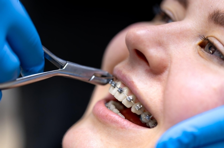Orthodontics